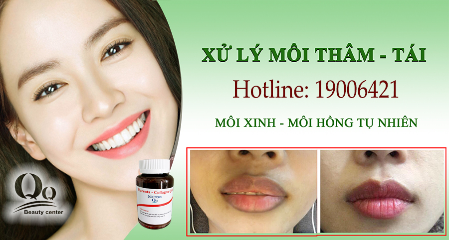Vien-uong-tri-tham-moi-Doctors-Q10-co-tot-khong.jpg