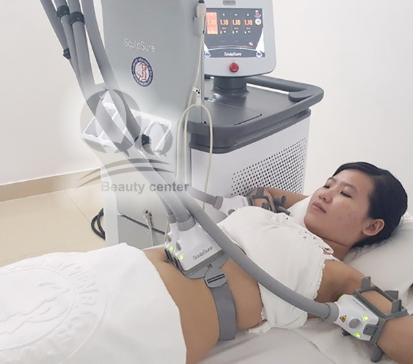 cong-nghe-giam-beo-laser-schulpsure.jpg