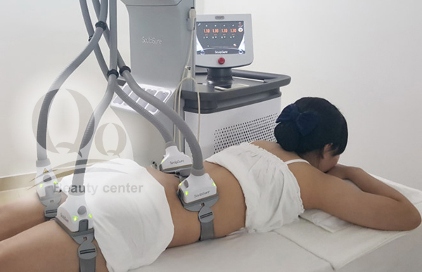 may-giam-beo-laser-sculpsure.jpg