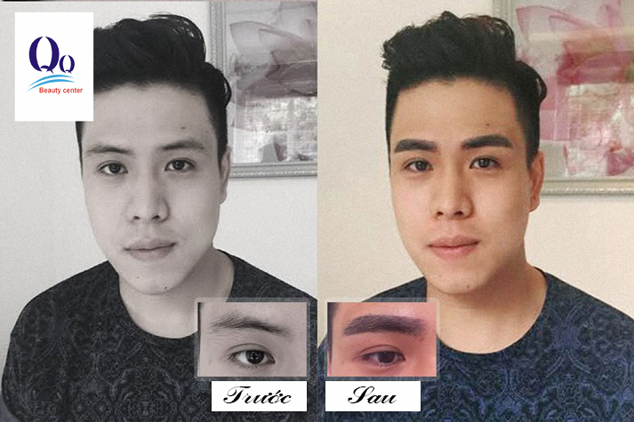 theu-long-may-o-tham-my-vien-kangnam.jpg